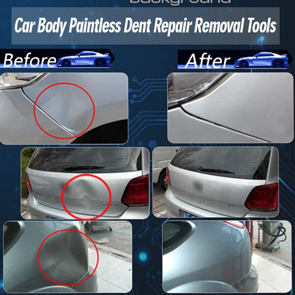 Anyyion 98pcs Paintless Dent Repair Kits,Car Body Dent Repair Tools Hail dent Removal Kit for Car Hail Damage Dent & Ding Remover（Full Set Starter Set Kits）